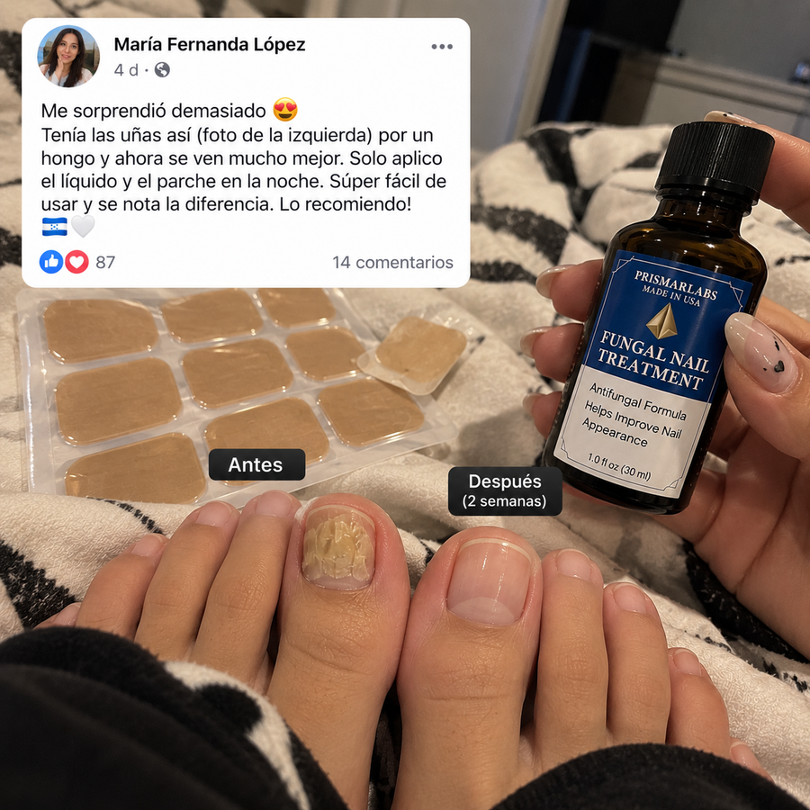 TRATAMIENTO HONGO FUNGAL NAIL — Parches de Hidrogel para Uñas