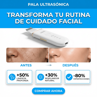 Espátula Ultrasónica Facial GUGUG – Limpiador Profundo + Removedor de Impurezas - Inversiones Alkosto